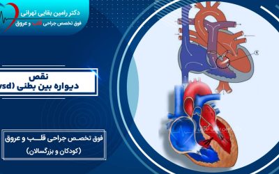 نقص دیواره بین بطنی (vsd) چیست؟