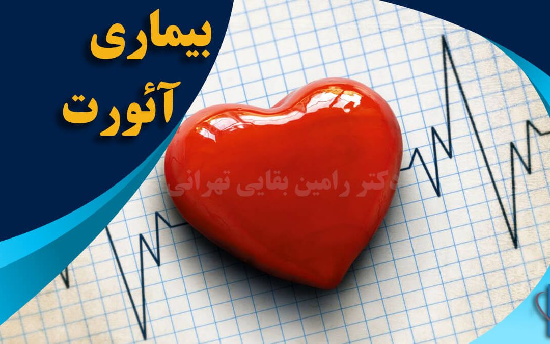 جراحي آئورت