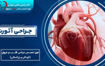 جراحی آئورت
