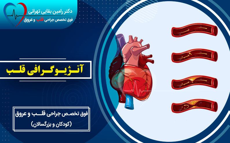 آنژیوگرافی قلب توسط بهترین دکتر قلب در تهران