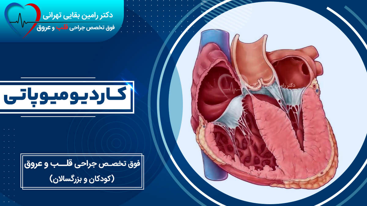 کاردیومیوپاتی قلب