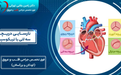 همه چیز درباره نارسایی دریچه سه لتی یا تریکوسپید؛ از علت ایجاد تا تشخیص و درمان