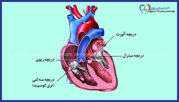  تصویر شماتیک برش‌خورده‌ای از قلب انسان را نشان می‌دهد که چهار دریچه اصلی (سه‌لتی، میترال، ریوی و آئورت) در آن مشخص شده‌اند.
