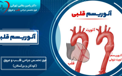 آنوریسم قلبی چیست؟ از علائم و انواع آن گرفته تا تشخیص و درمان
