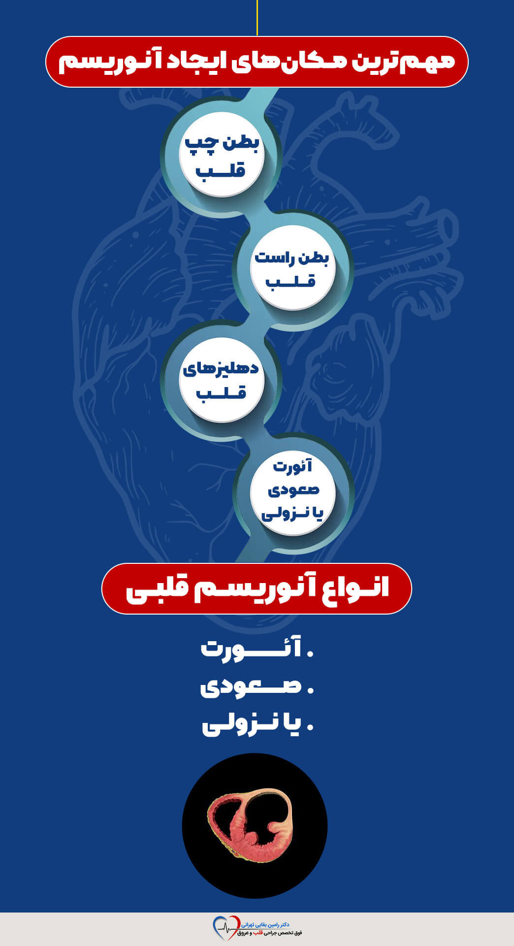 اینفوگرافیک محل‌های ایجاد و انواع آنوریسم قلبی