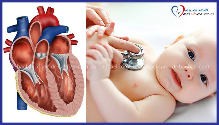 تصویر دو بخشی: در سمت چپ، برش آناتومیک قلب انسان با نمایش دریچه‌ها. در سمت راست، پزشک در حال معاینه قفسه سینه نوزاد با استفاده از گوشی پزشکی.