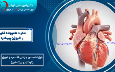تفاوت تامپوناد قلبی و افیوژن پریکارد چیست؟ نگاهی علمی به دو بیماری پریکاردیال