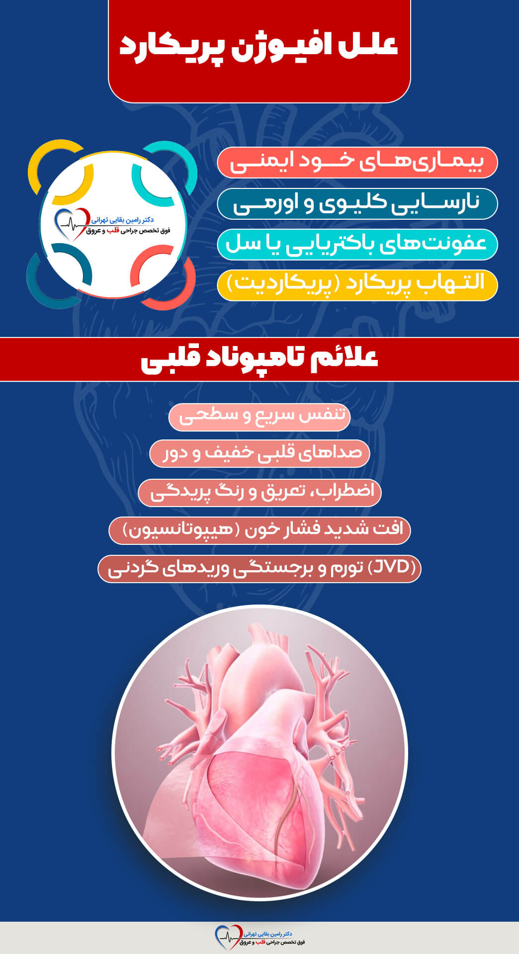 علل و علائم تامپوناد و افیوژن پریکارد: شامل بیماریهای خود ایمنی، نارسایی کلیوی، عفونتهای باکتریایی/سل، و پریکاردیت به عنوان علل. علائم شامل تنفس سریع، صداهای قلبی خفیف، اضطراب، تعریق، رنگپریدگی، افت شدید فشار خون (هیپوتانسیون)، و تورم و برجستگی وریدهای گردنی (JVD) است. این تصویر یک قلب انسان را در پایین نشان میدهد و توسط یک پزشک متخصص قلب و عروق تهیه شده است.