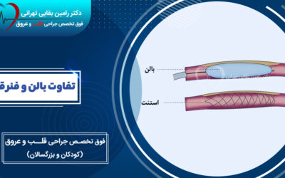 تفاوت بالن و فنر قلب، کدام روش برای باز کردن رگهای مسدود بهتر است؟