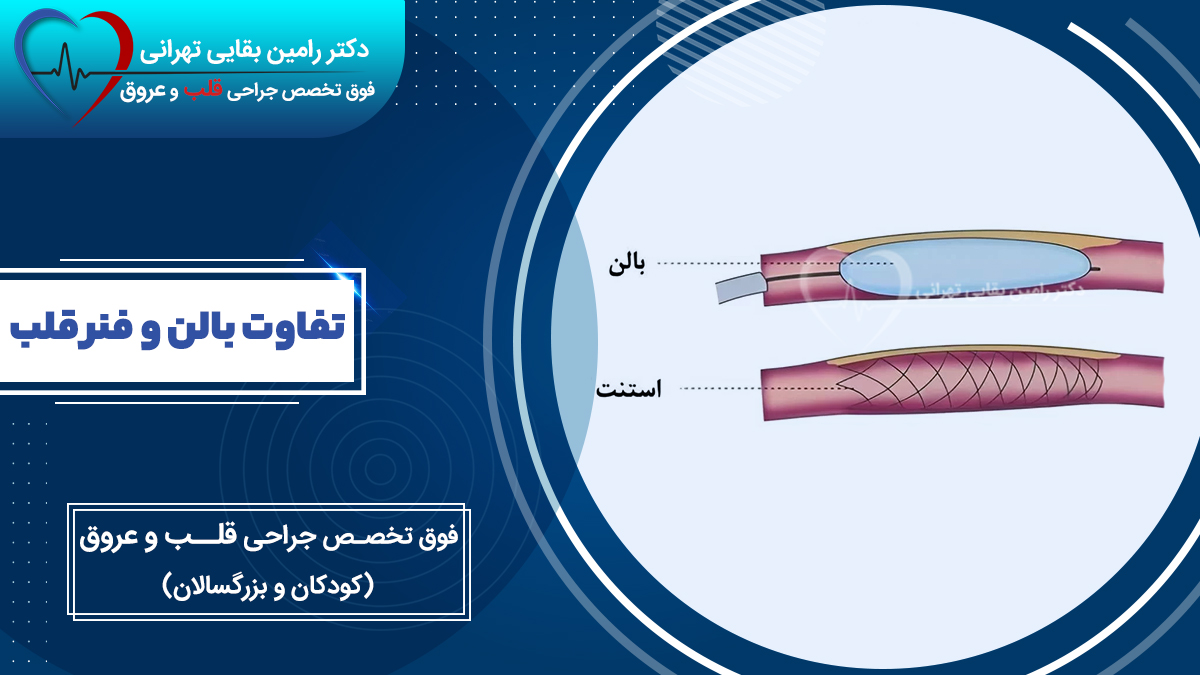 difference-between-balloon-angioplasty-and-stent مقایسه و تفاوت بالن و فنر قلب (استنت) در فرآیند آنژیوپلاستی عروق کرونر.