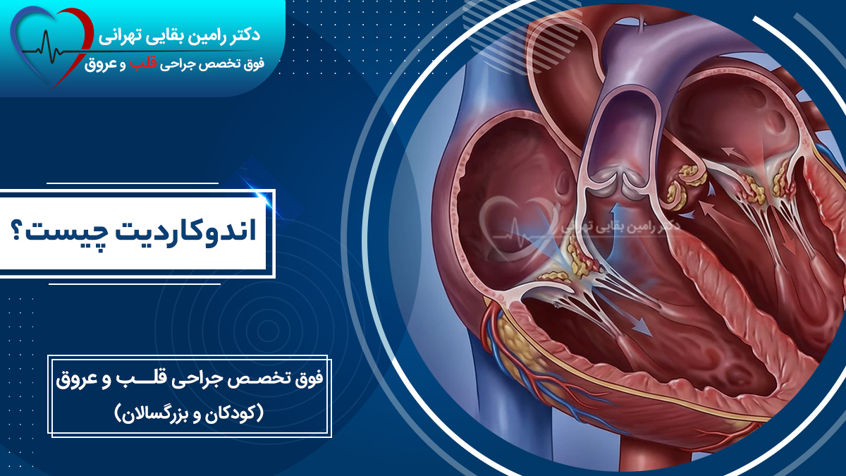what-is-endocarditis-medical-infographic اندوکاردیت چیست، شامل تصویر مقطعی قلب و نمایش تخریب دریچهها توسط عوامل عفونی.