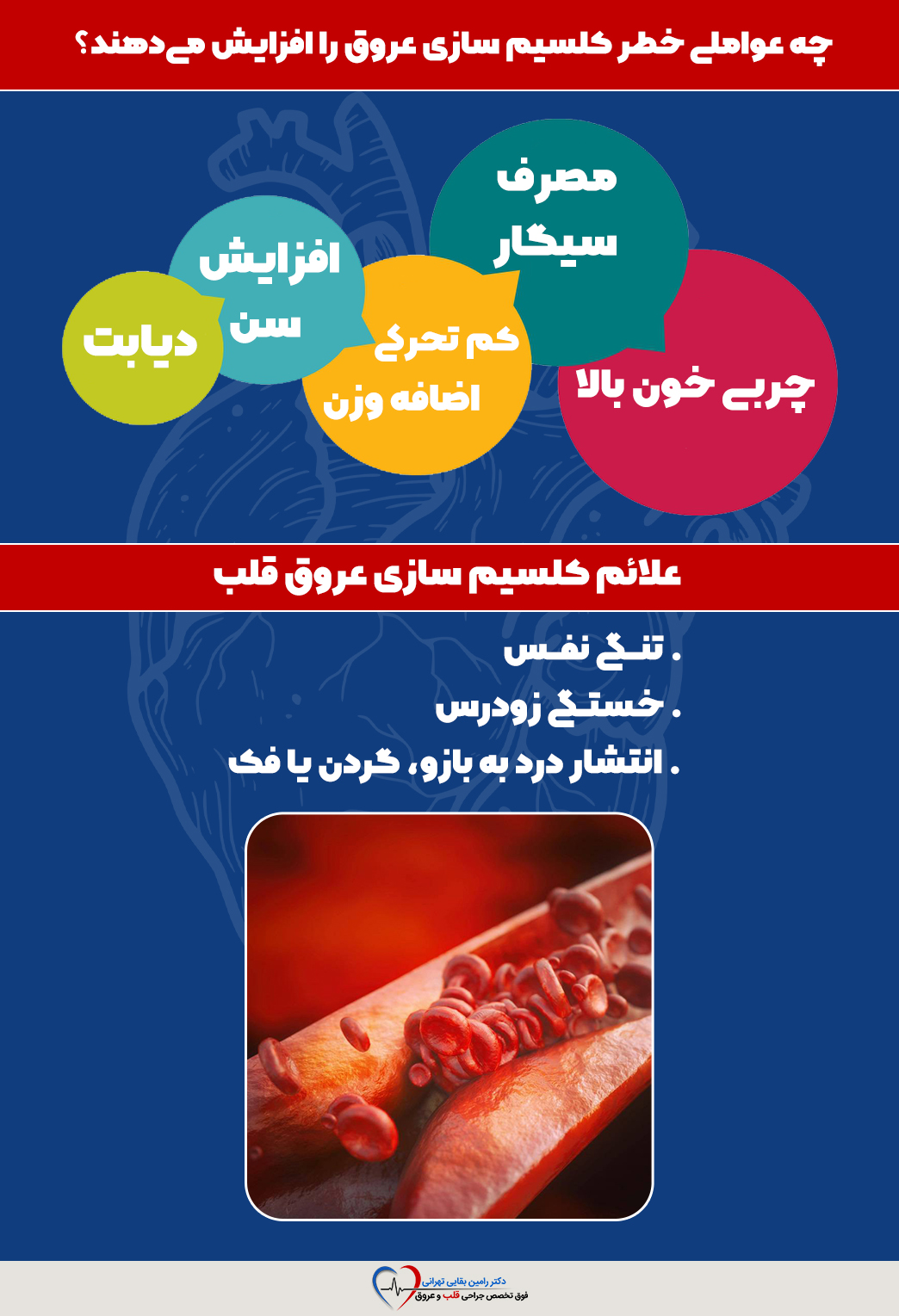اینفوگرافیک عوامل خطر کلسیم سازی عروق (مانند سیگار، دیابت، چربی خون بالا) و علائم آن شامل تنگی نفس، خستگی زودرس و درد قفسه سینه