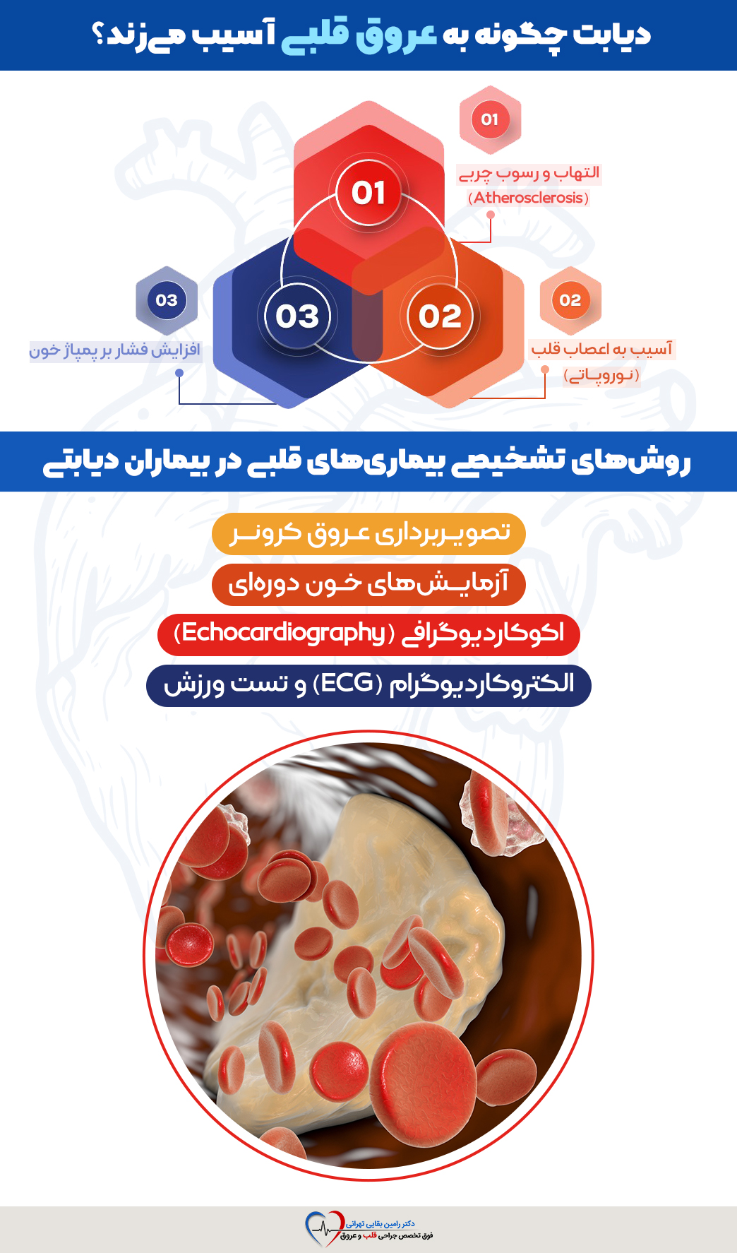 اینفوگرافیک روشهای تشخیص بیماریهای قلبی در بیماران دیابتی و راههای آسیب دیابت به عروق