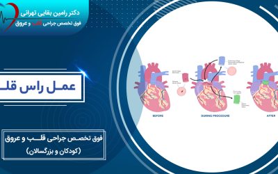 عمل راس قلب چیست؟ مزایا، معایب و کاندیدای مناسب