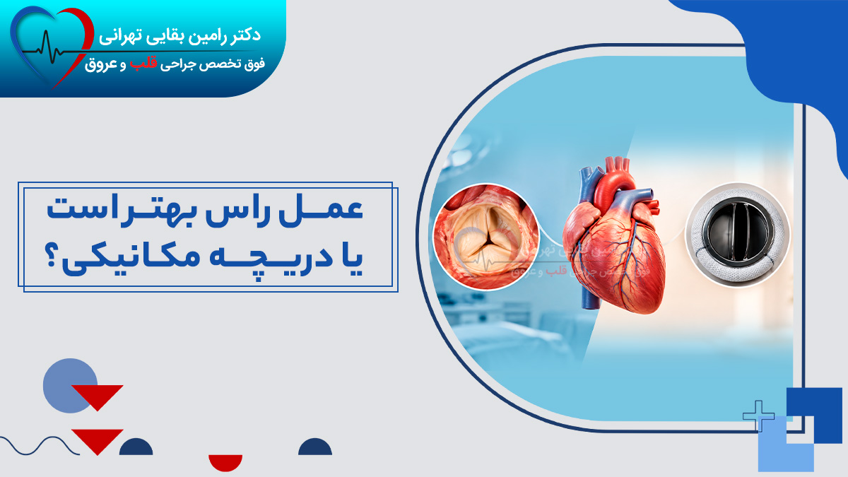 مقایسه جامع عمل راس و تعویض دریچه مکانیکی قلب، کدام یک بهتر است؟